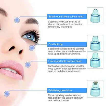 Cell Operated Blackhead Removal Machine